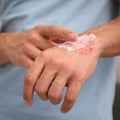Slow-Healing Wounds