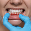 Swollen or Red Gums