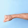 Visible Bulge or Lump