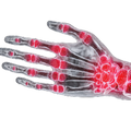 Joint Pain and Tenderness