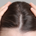 Reduced Hair Volume