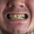 Brown, Black or White Stains