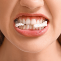 Pain While Chewing